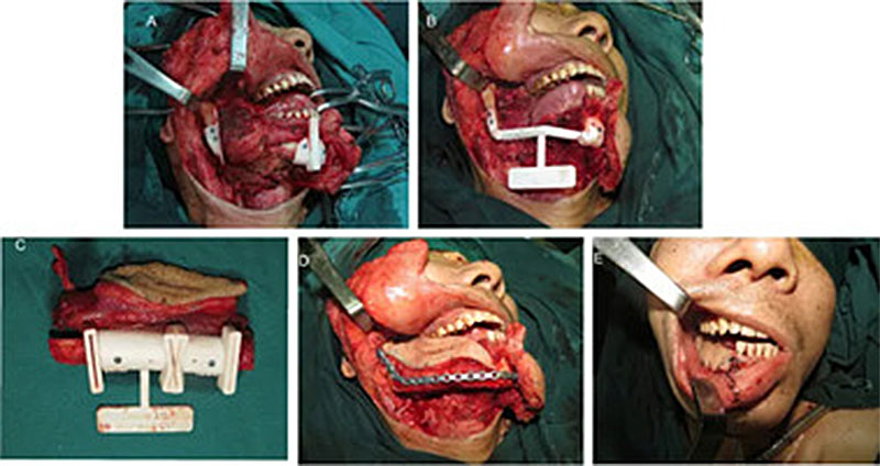 Maxillofacial and Oral Surgery